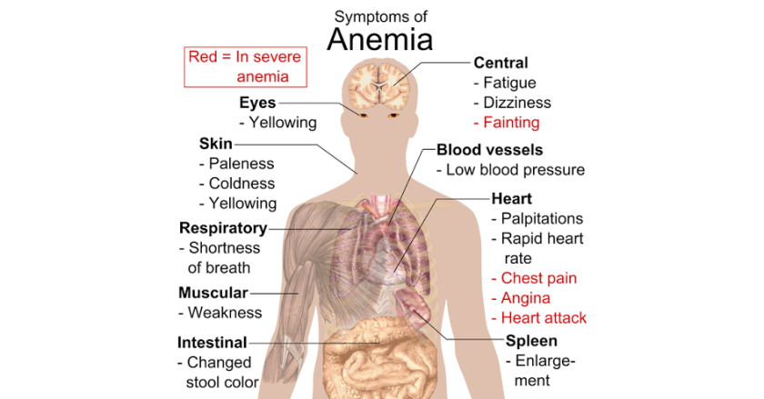 Anemia.png